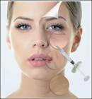 крест 1ml 1.1ml соединил Hyaluronic кисловочные дермальные заполнители для щеки Midface носа