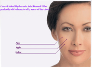 Заполнитель безопасного эффективного геля HA дермальный для уменьшения лицевых шрамов депрессий