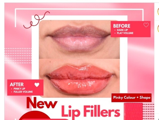 HYDROIAM Kiss with B12 Ha Filler Red Lips Filler Hyaluronic Acid Filler обеспечивает естественный объем и цвет
