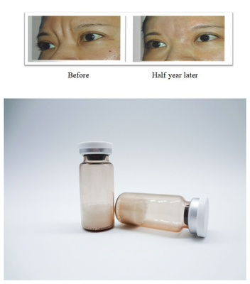 Инъекционный PLLA поли- L- молочная кислота Dermal Filler Удаляет морщины на лице Стимулирует регенерацию коллагена