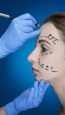 Гладкие морщины и четкое выражение челюсти с помощью лицевых дермальных наполнителей 70% HA Cross Linked 24mg 30% кальция гидроксилапатит