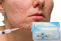 вводимый Hyaluronic кисловочный дермальный заполнитель 10ml для исправлять лицевую асимметрию