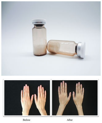 Стерильные наполнители для кожи лица PLLA гиалуроновая кислота инъекционный гель, предназначенный для плавной коррекции морщин и восстановления объема лица