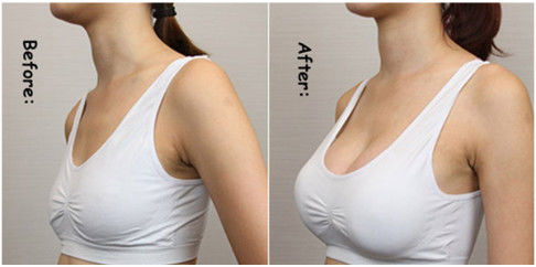 Hyaluronic кисловочный гель повышения Hyaluronate натрия груди заполнителя впрыски груди