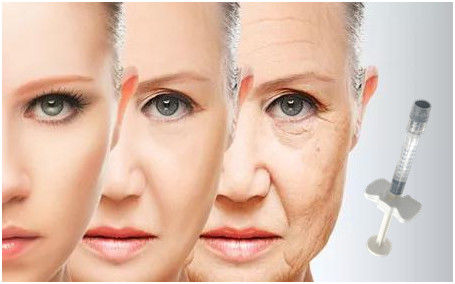 Hyaluronic кисловочный заполнитель 24mg/Ml стороны для ног ворон депрессий щеки